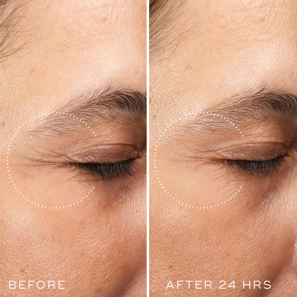 Copyof20230203-CrystalRetinalCeramideEye-ExtendedProductPageAssets-BeforeandAfter24hrs-V2-1000x1000-ForWeb