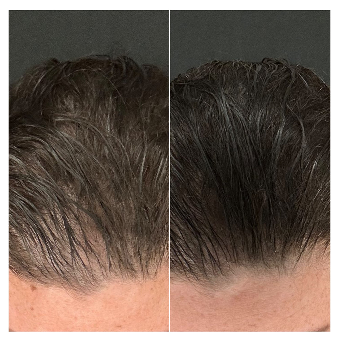 AHS_New format_B&A_01