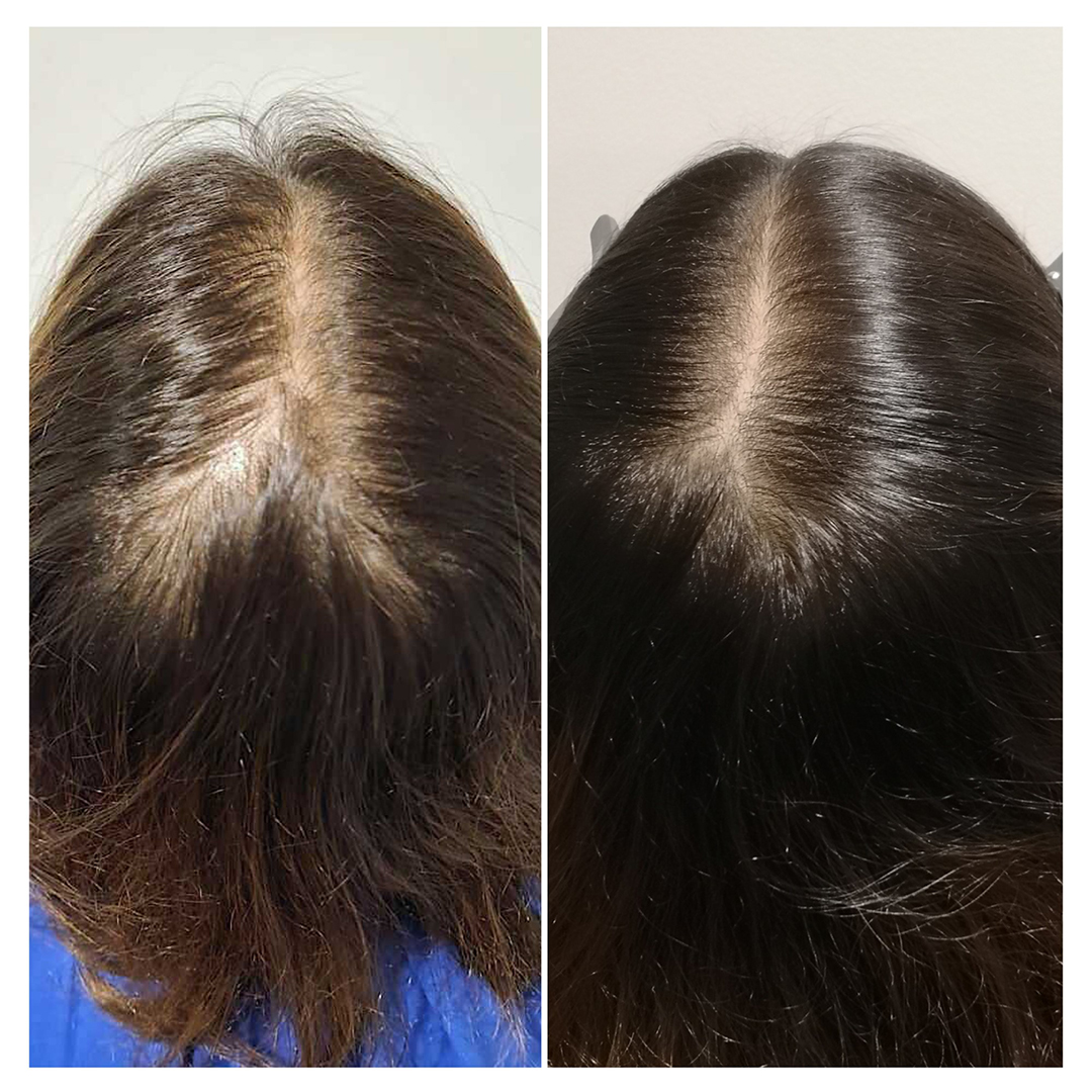 AHS_New format_B&A_01